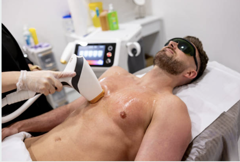 Láser y fotodepilación Hombre zonas XL